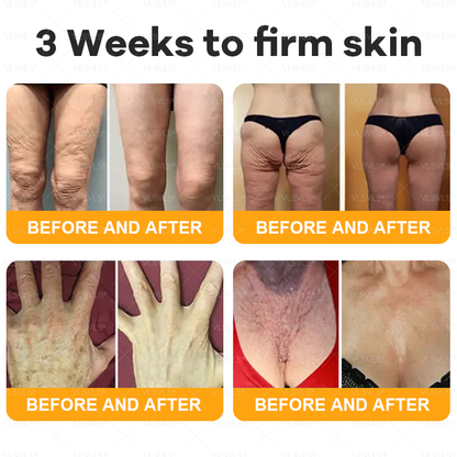 Made and Shipped from UK 💖VLSVLS® Bee Venom Comprehensive Cream  LAST DAY 80% OFF (Suitable for all ages)