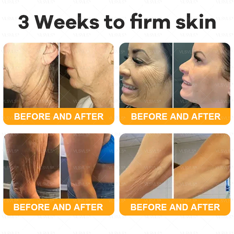 Made and Shipped from UK 💖VLSVLS® Bee Venom Comprehensive Cream  LAST DAY 80% OFF (Suitable for all ages)
